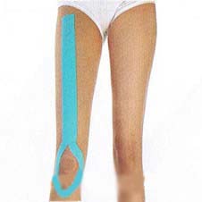 Kinesio Taping 康复肌内效贴法