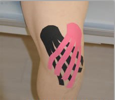 Kinesio Taping 康复肌内效贴法