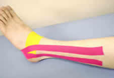 Kinesio Taping 康复肌内效贴法