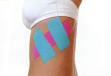 Kinesio Taping 康复肌内效贴法