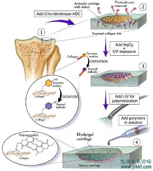 膝关节解剖与生物力学