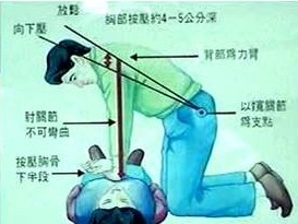 最新版心肺复苏方法（CPR)