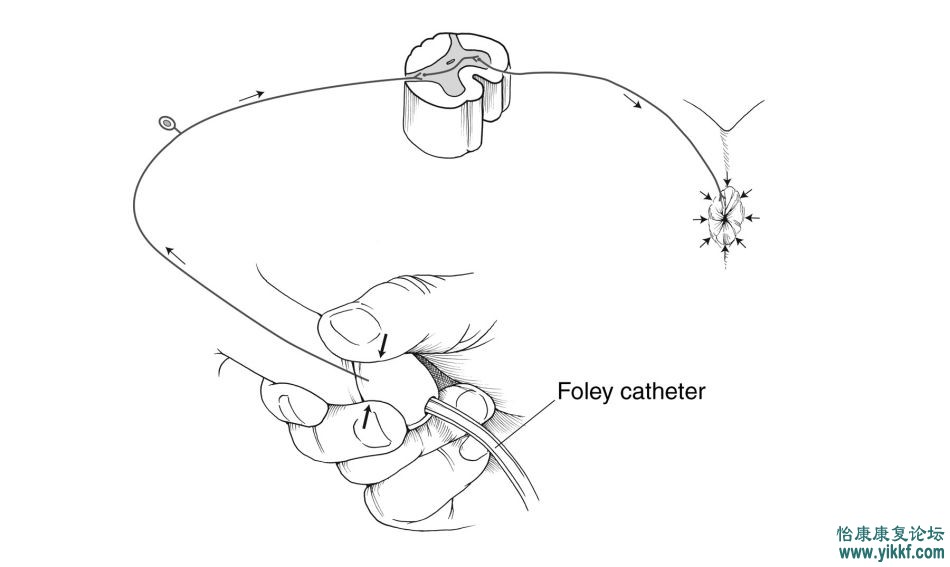 球海绵体反射（Bulbocavernosus Reflex）