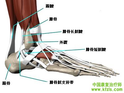 腓骨肌腱脱位(Peroneal tendon dislocation)