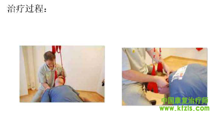 Neurac 技术在颈肩腰腿痛中的应用-福建林汉凌