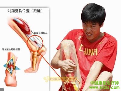 跟腱断裂缝合术后康复方案