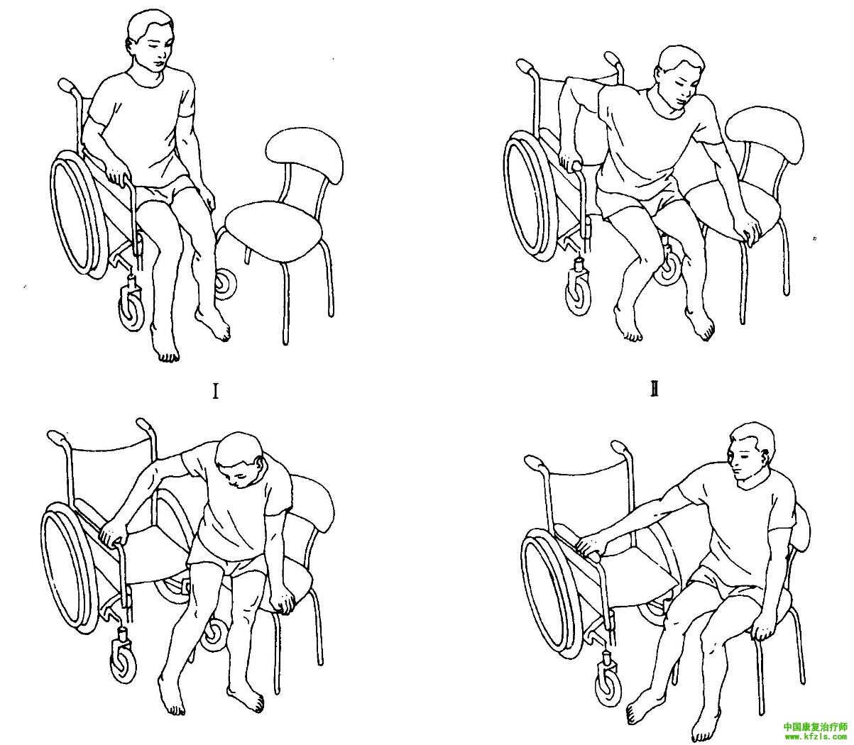 截瘫患者从轮椅到床的侧方成角转移（从左侧转移）