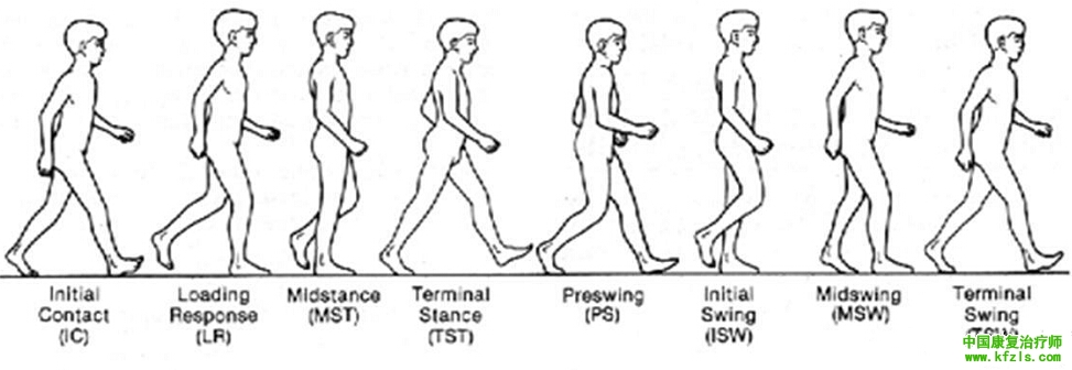 常见的异常步态分析及矫治方法
