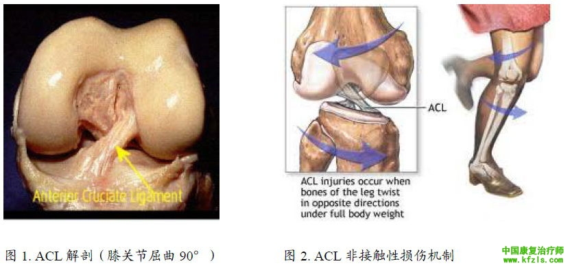 前交叉韧带损伤的防治