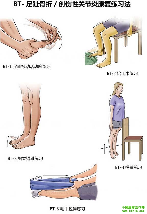 足趾骨折/创伤性关节炎康复练习法
