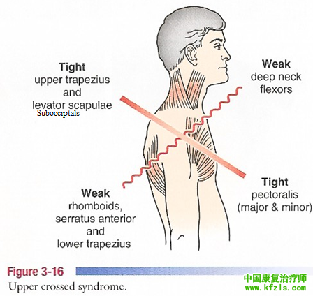 颈椎强直训练