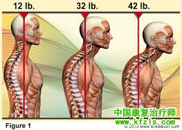 颈椎强直训练