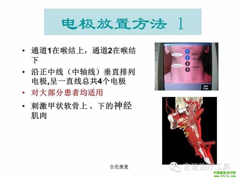 吞咽电极片放置