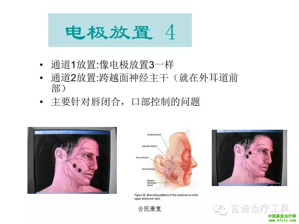 吞咽电极片放置