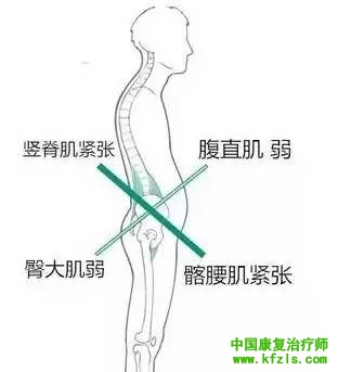 下交叉综合症