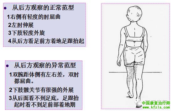 步态分析