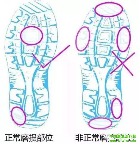 感觉统合