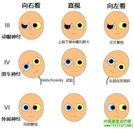 动眼神经、滑车神经和外展神经