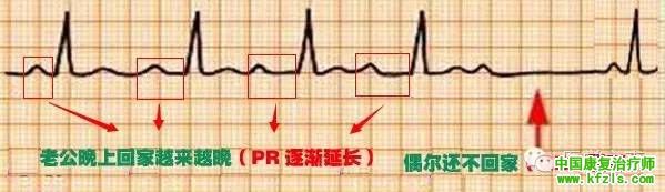 心电图
