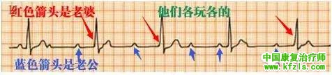 心电图