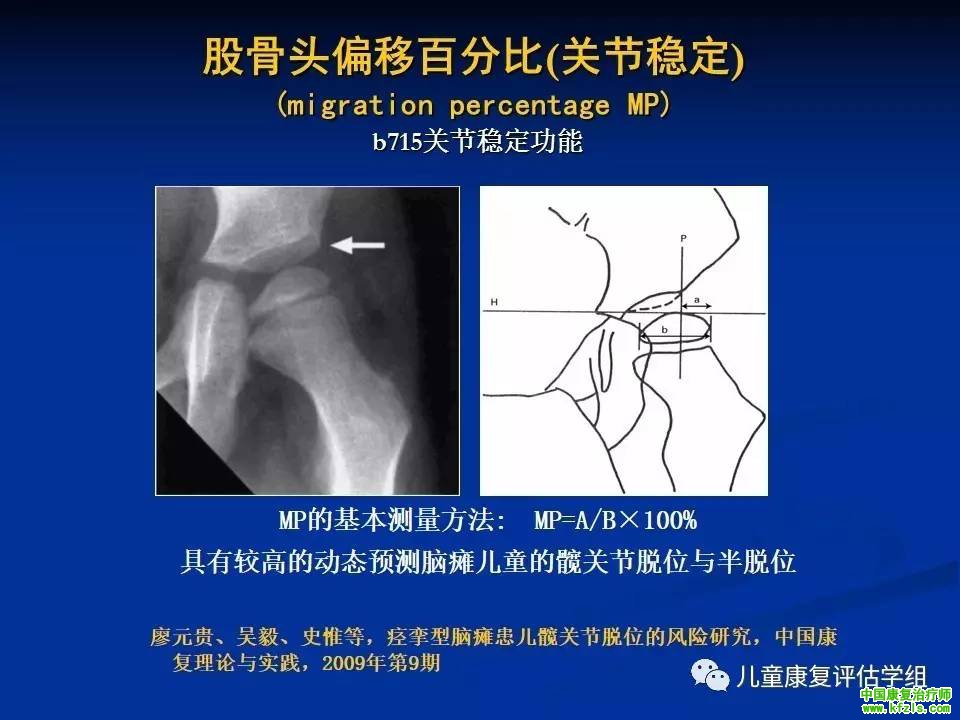 ICF-CY框架下脑瘫儿童评估