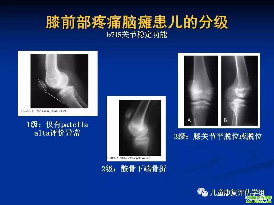 ICF-CY框架下脑瘫儿童评估