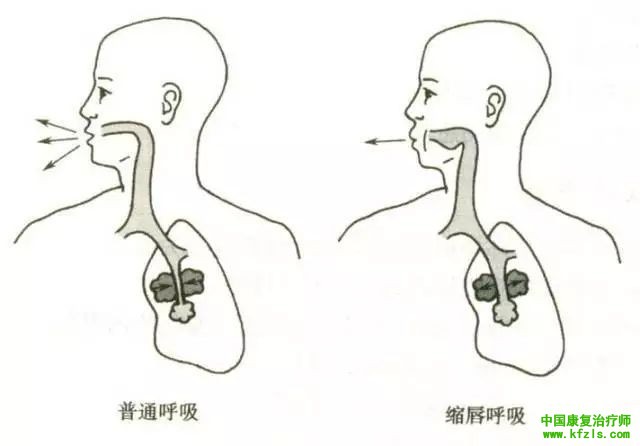 肺功能康复训练