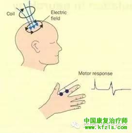 运动阈值（MT）