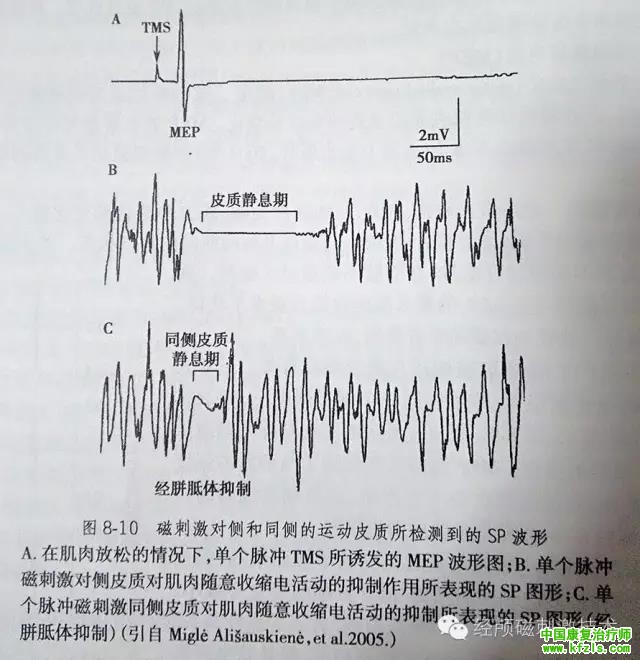 皮质静息期（CSP）