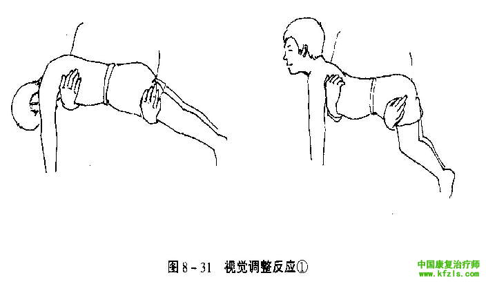 原始反射检查