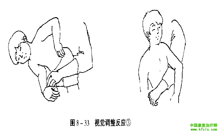 原始反射检查