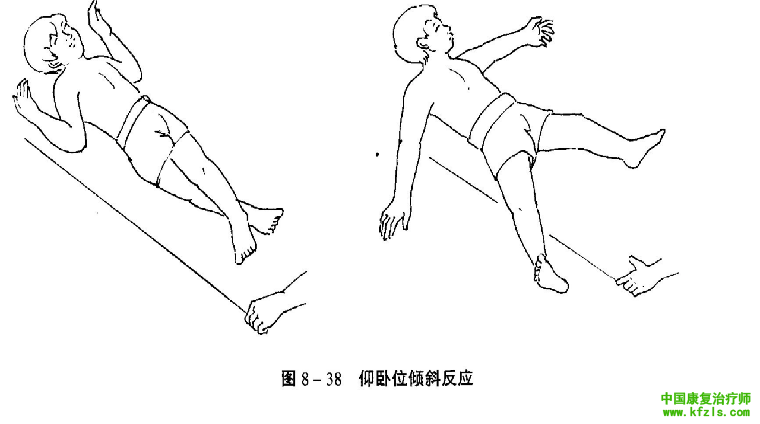 原始反射检查