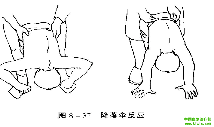 原始反射检查