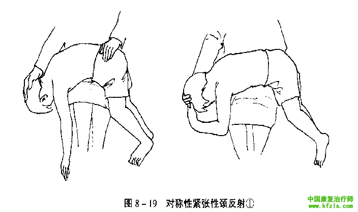 原始反射的检查