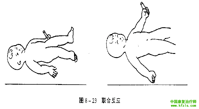 原始反射的检查