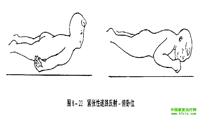 原始反射的检查