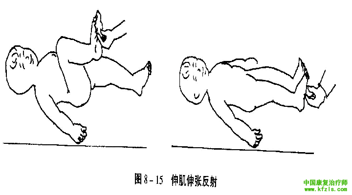 脊髓水平的原始反射