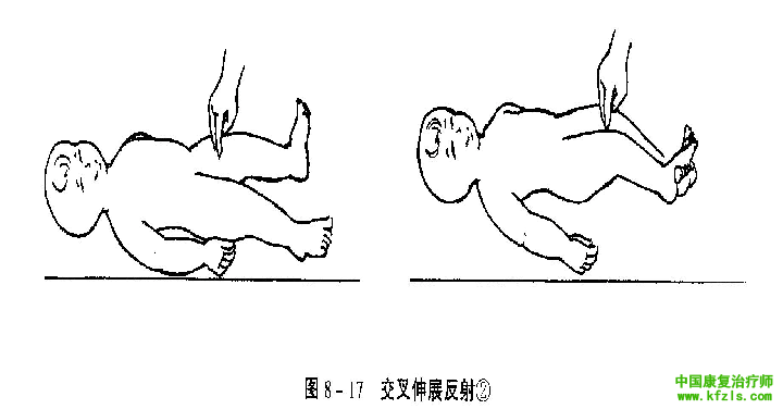 脊髓水平的原始反射