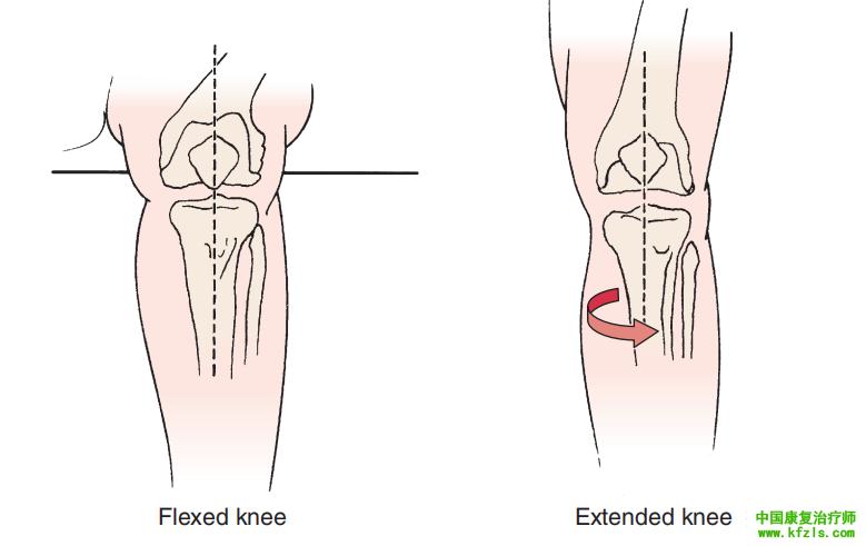 膝部的的特殊检查