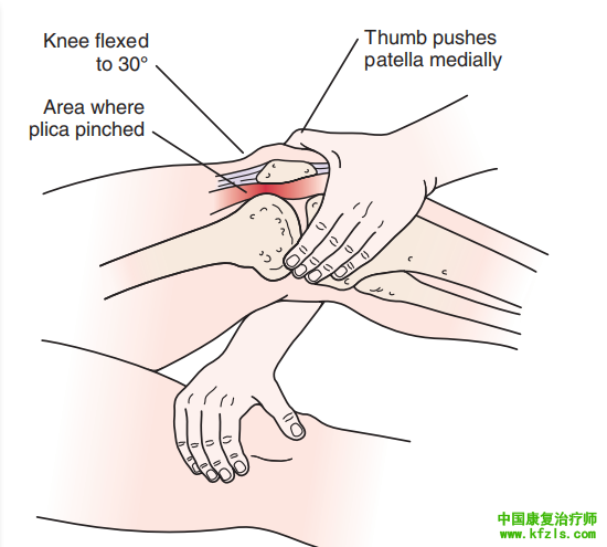 膝部的的特殊检查