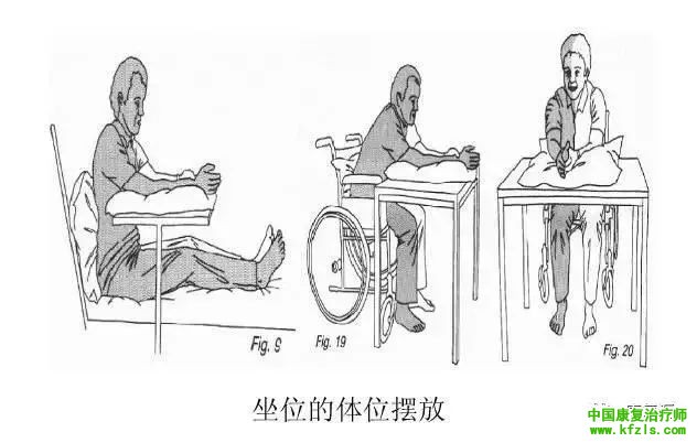 肩手综合征临床康复治疗方案