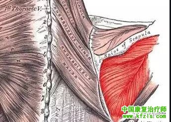 可能引发肩关节疼痛的肌肉总结（图文）