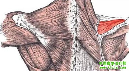 可能引发肩关节疼痛的肌肉总结（图文）