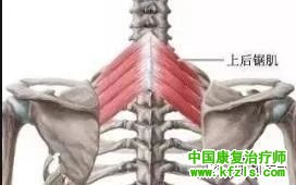 可能引发肩关节疼痛的肌肉总结（图文）