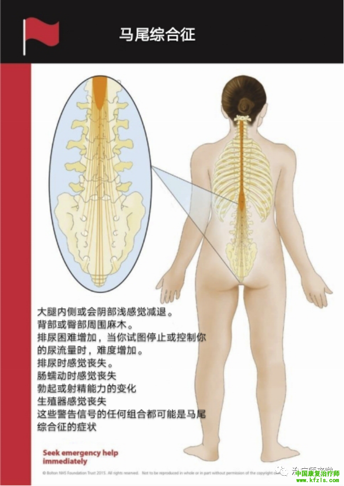 马尾综合征的评估与管理