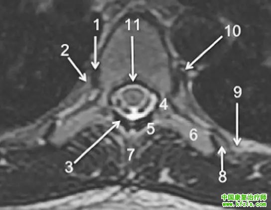 早读 | 胸、腰椎MRI解剖，9张高清图注帮你速记!