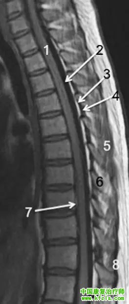 早读 | 胸、腰椎MRI解剖，9张高清图注帮你速记!