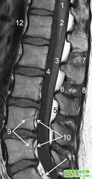 早读 | 胸、腰椎MRI解剖，9张高清图注帮你速记!