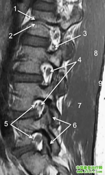 早读 | 胸、腰椎MRI解剖，9张高清图注帮你速记!