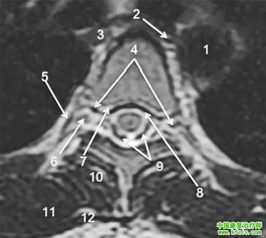 早读 | 胸、腰椎MRI解剖，9张高清图注帮你速记!